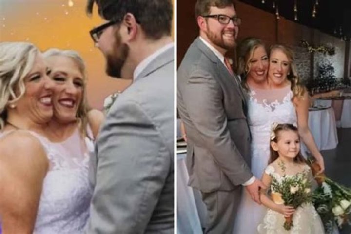 Conjoined Twins Abby and Brittany Hensel Married Now, Wedding Details, Boyfriend 2019