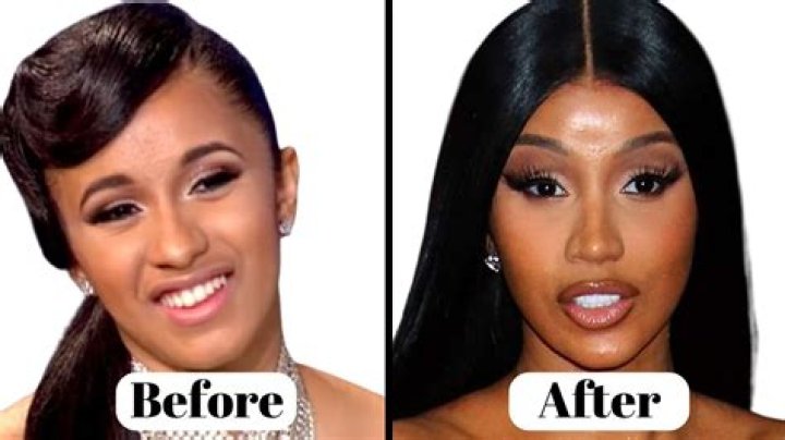 How Much Did Cardi BS Teeth Cost? Celebrity