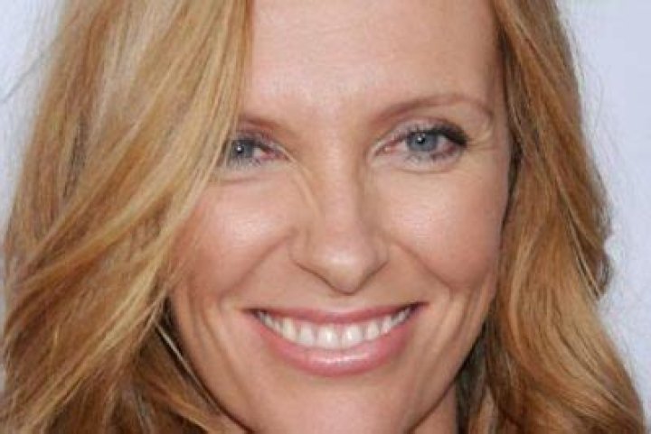 Toni Collette Teeth Before And After